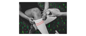 injury